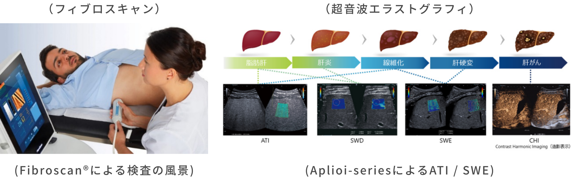 脂肪肝専門外来について