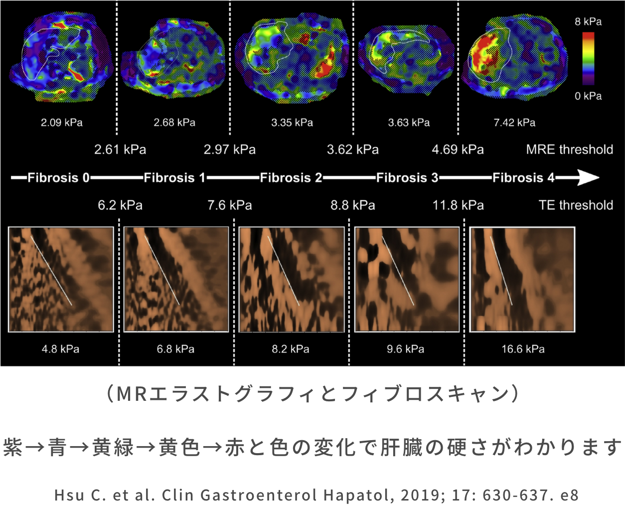 脂肪肝専門外来について