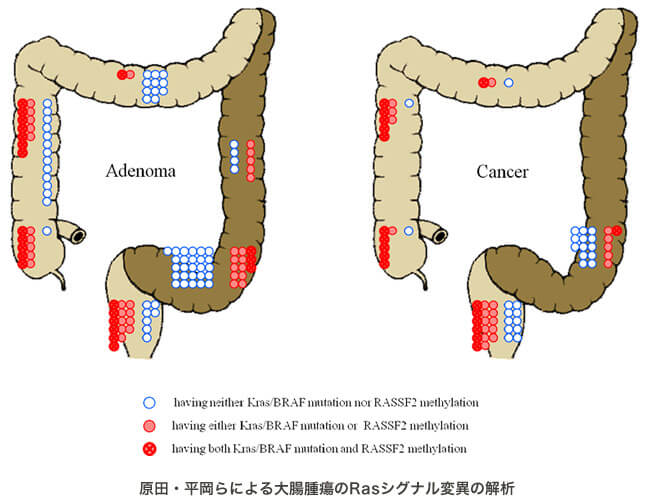 原田。平岡らによる、大腸腫瘍Rasシグナル変異の解析のイラスト